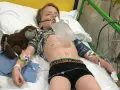 Chłopiec w szpitalnym łóżku z maską tlenową, podłączony do aparatury. To obraz walki z zapaleniem opon mózgowych u dzieci.