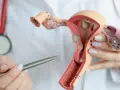 Model anatomiczny narządów rodnych kobiety, prezentowany przez lekarza z długopisem.