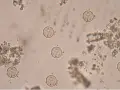 Mikroskopowe jajeczka owsików, które mogą być widoczne podczas poszukiwań sposobów, jak pozbyć się owsików bez leków.