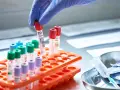 Ręka w rękawiczce pobiera probówkę z próbką krwi. Wyniki badań mogą wskazywać na podwyższone płytki krwi u dziecka.