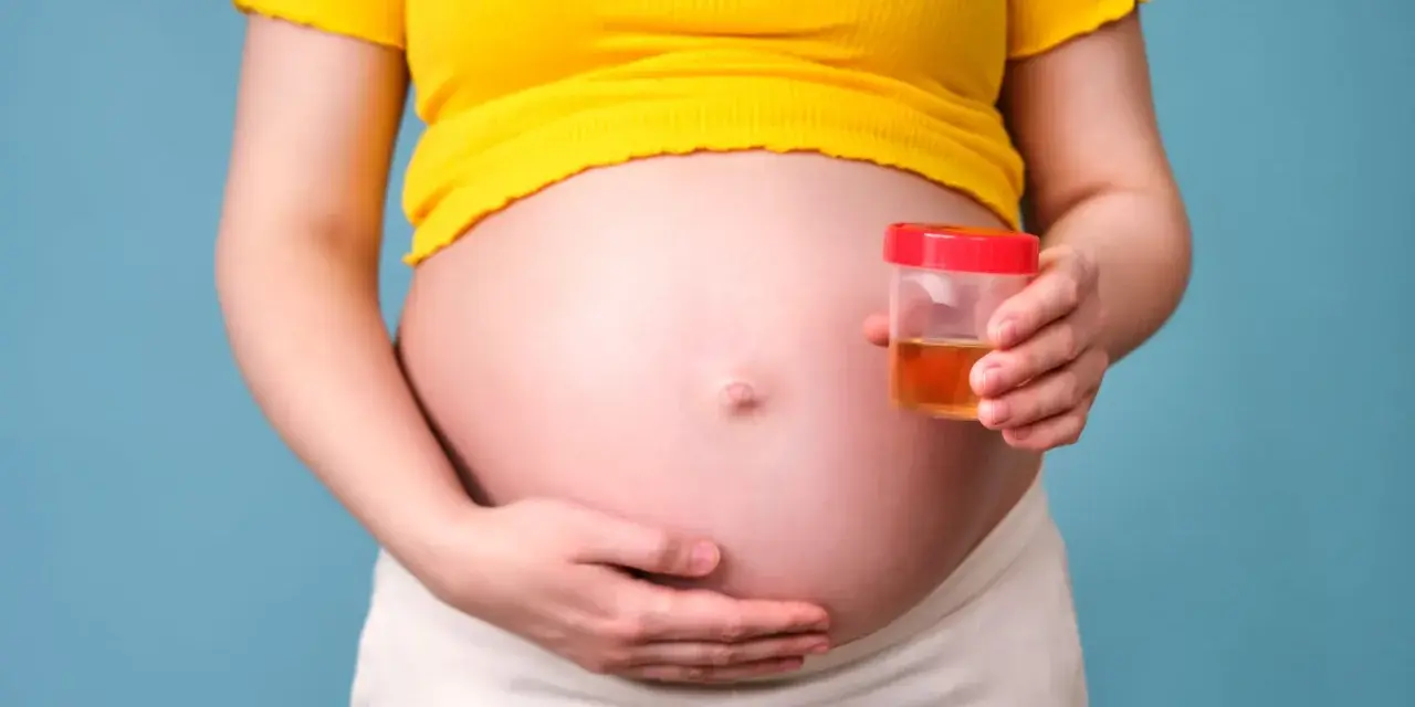 Ciężarna kobieta trzyma pojemnik z próbką moczu, badanie na obecność ketonów w moczu w ciąży.