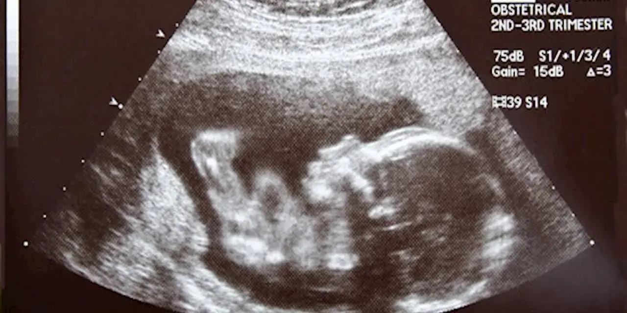 Badanie USG płodu w 2. lub 3. trymestrze ciąży.