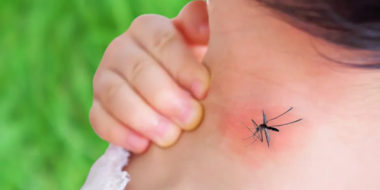 Dziecko drapie zaczerwienione miejsce na szyi po ukąszeniu komara. Rumień jest widoczny.