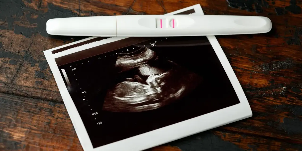 Test ciążowy z dwoma kreskami i zdjęcie USG. To początek pięknej podróży, 7 tydzień ciąży.