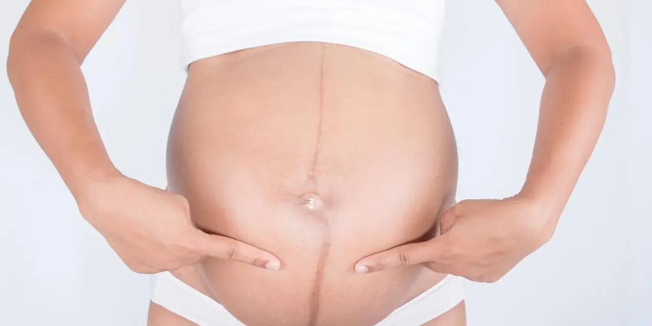 Ciężarna kobieta wskazuje palcami na ciemną linię biegnącą przez środek brzucha, zwaną linea negra.