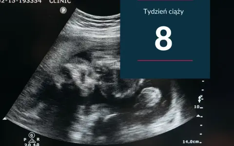 USG pokazuje zarodek w 8 tygodniu ciąży. Rozwija się nowe życie.