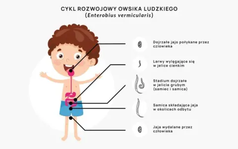 Owsiki w żłobku: Kiedy dziecko wraca? Poradnik dla rodziców