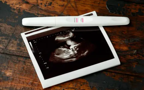 Test ciążowy z dwoma kreskami i zdjęcie USG. To początek pięknej podróży, 7 tydzień ciąży.
