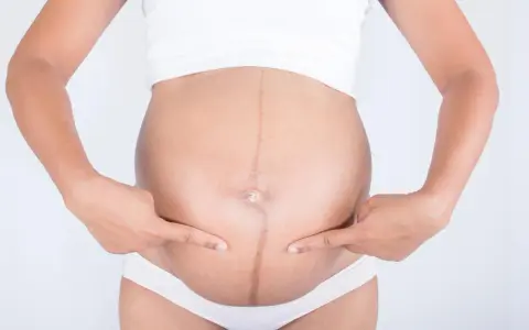 Ciężarna kobieta wskazuje palcami na ciemną linię biegnącą przez środek brzucha, zwaną linea negra.