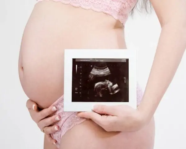 Ciężarna kobieta trzyma zdjęcie USG. To badanie, które pokazuje, co oznacza rozwój dziecka.