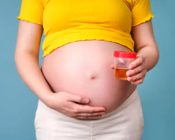 Ciężarna kobieta trzyma pojemnik z próbką moczu, badanie na obecność ketonów w moczu w ciąży.