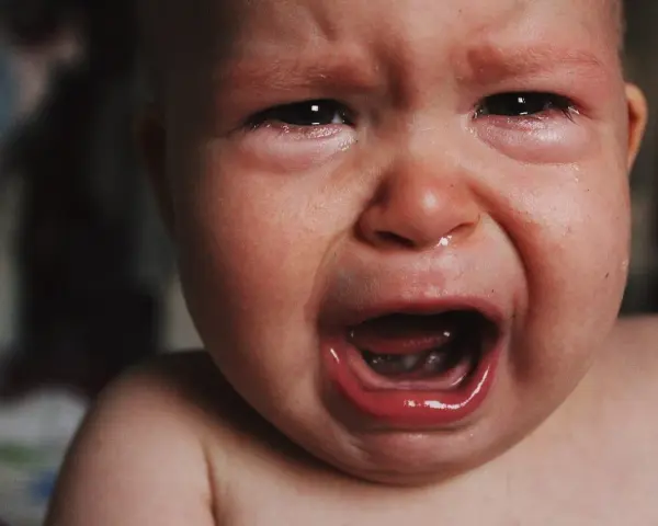 Malutkie dziecko płacze, ma zaczerwienione oczy i mokry nosek. To pewnie katar przy ząbkowaniu, który sprawia mu ból.