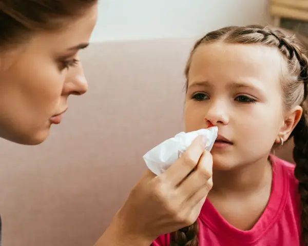 Mama delikatnie przykłada chusteczkę do nosa dziecka, na którym widać ślady krwi.