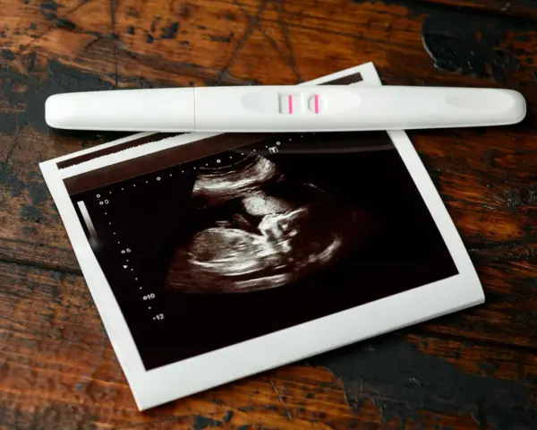 Test ciążowy z dwoma kreskami i zdjęcie USG. To początek pięknej podróży, 7 tydzień ciąży.