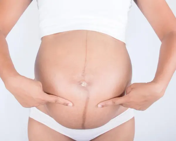 Ciężarna kobieta wskazuje palcami na ciemną linię biegnącą przez środek brzucha, zwaną linea negra.