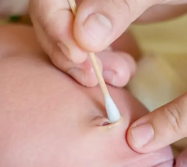 Delikatne czyszczenie pępka niemowlaka patyczkiem, gdy odpada kikut. Skóra dziecka jest różowa, a dłoń rodzica ostrożnie przytrzymuje pępek.