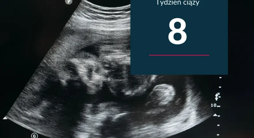 USG pokazuje zarodek w 8 tygodniu ciąży. Rozwija się nowe życie.