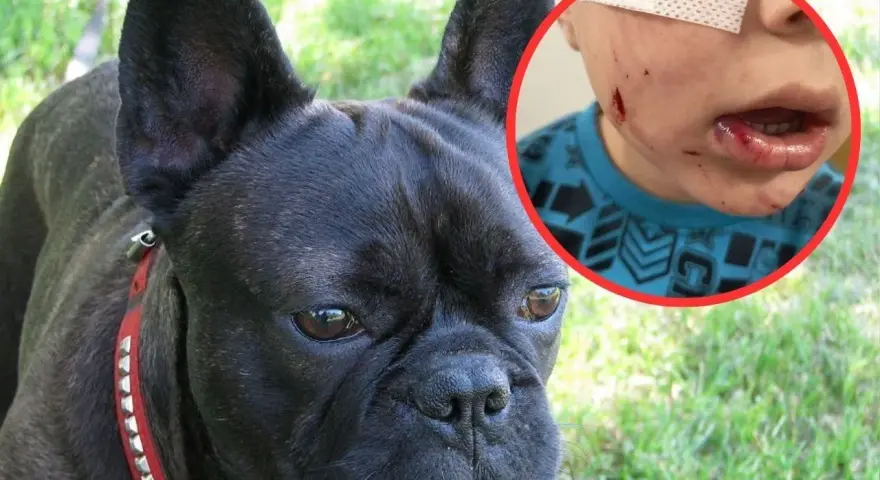 Czarny buldog francuski obok dziecka z ranami na twarzy i ustach, opatrzonymi plastrem.