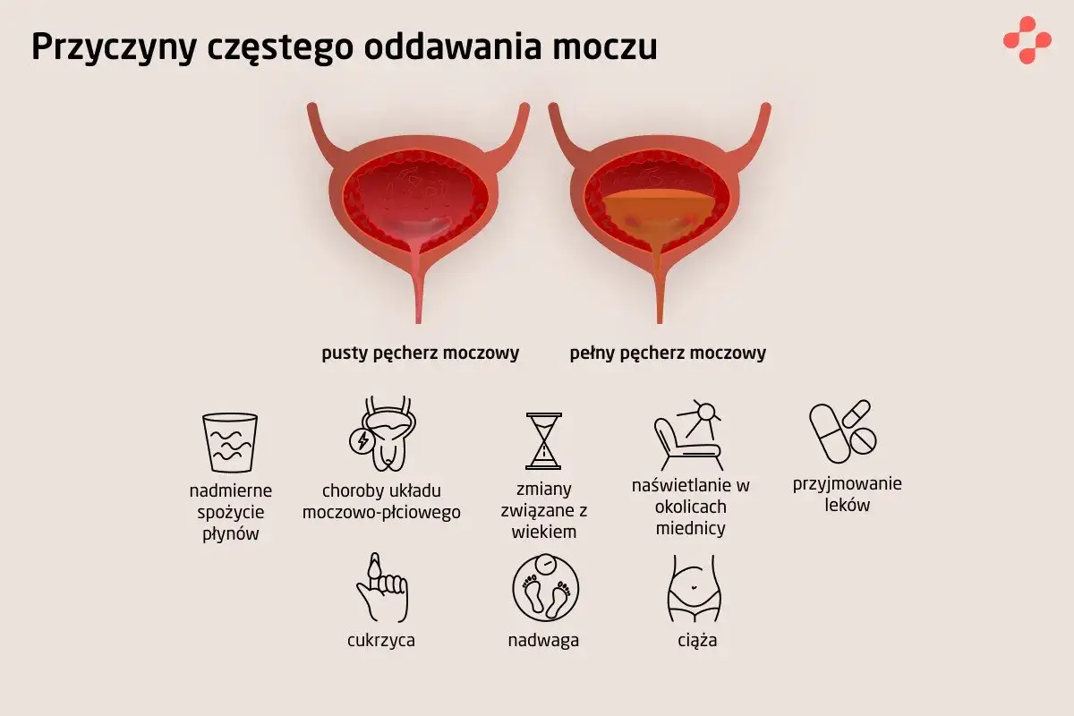 Ilustracja przedstawia przyczyny częstego oddawania moczu u dziecka: nadmierne picie, choroby układu moczowo-płciowego, zmiany związane z wiekiem, naświetlanie, leki, cukrzyca, nadwaga, ciąża.