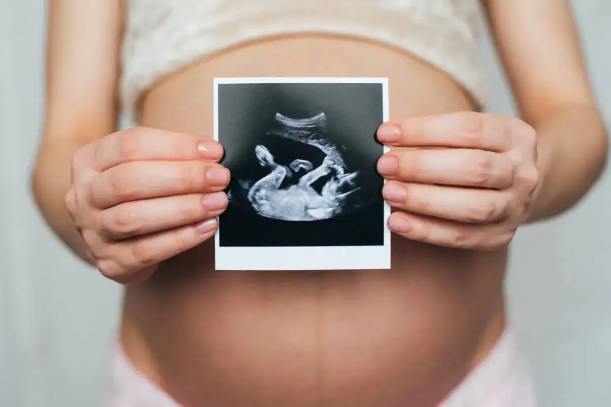Kobieta trzyma zdjęcie USG, na którym widać dziecko. Badanie wykazało łożysko na przedniej ścianie.