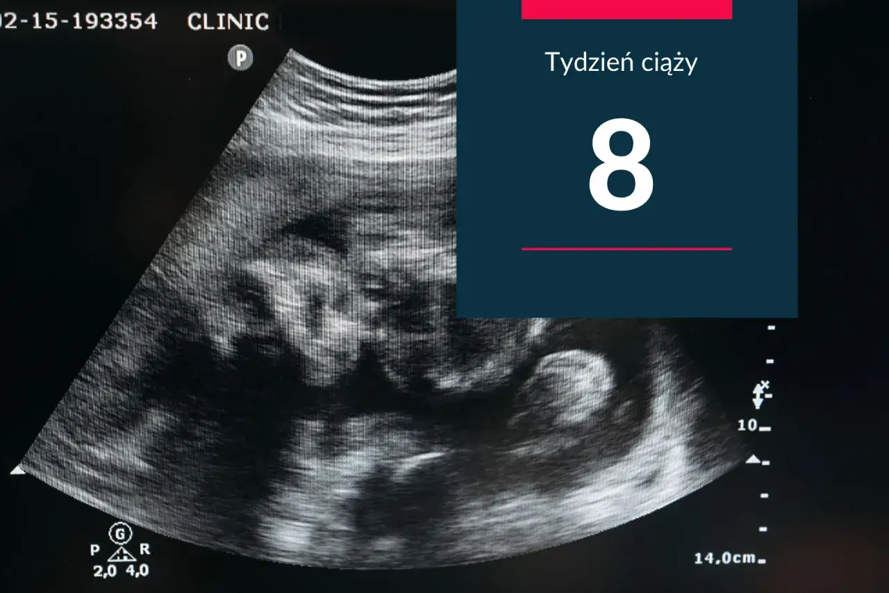 USG pokazuje zarodek w 8 tygodniu ciąży. Widać jego kształt i rozwój.