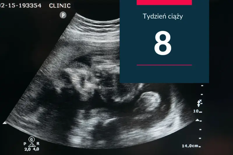 USG pokazuje zarodek w 8 tygodniu ciąży. Rozwija się nowe życie.